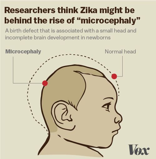 Zika Virus causes panic